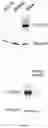 Fig. 04 - Compounds, compositions and methods for cancer treatment