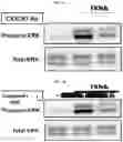 Fig. 02 - Substituted pyrrolo[1,2-a]quinoxalin-4(5H)-ones as CX3CR1 antagonists