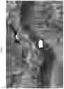 Fig. 03 - Substituted pyrrolo[1,2-a]quinoxalin-4(5H)-ones as CX3CR1 antagonists