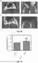 Fig. 16 - Bioreducible N-oxide-based probes for imaging of hypoxia