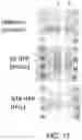 Fig. 17 - Peptide-MHC compacts