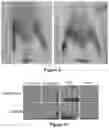 Fig. 07 - Method for Treating Ischemic Tissue