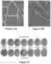 Fig. 09 - Method for Treating Ischemic Tissue