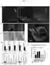 Fig. 02 - Compositions and methods for treating and/or preventing pathogenic fungal infection and for maintenance of microbiome commensalism