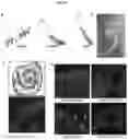 Fig. 18 - Compositions and methods for treating and/or preventing pathogenic fungal infection and for maintenance of microbiome commensalism