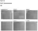 Fig. 78 - METHODS OF PREVENTING INFLAMMATION AND TREATING PAIN USING ANTI-NGF COMPOSITIONS