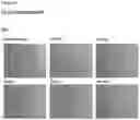 Fig. 79 - METHODS OF PREVENTING INFLAMMATION AND TREATING PAIN USING ANTI-NGF COMPOSITIONS