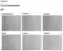 Fig. 81 - METHODS OF PREVENTING INFLAMMATION AND TREATING PAIN USING ANTI-NGF COMPOSITIONS