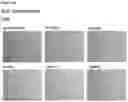 Fig. 86 - METHODS OF PREVENTING INFLAMMATION AND TREATING PAIN USING ANTI-NGF COMPOSITIONS