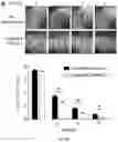 Fig. 25 - COMPOSITIONS AND METHODS OF PROMOTING WOUND HEALING