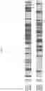 Fig. 05 - Glycosynthase variants for glycoprotein engineering and methods of use