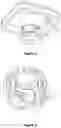 Fig. 04 - Adipose tissue splitting kit