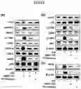 Fig. 24 - Lactic acid bacteria capable of controlling blood sugar and use thereof
