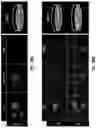 Fig. 35 - Acceleration of stem cell differentiation