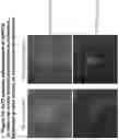 Fig. 14 - TRANSCRIPTION FACTORS CONTROLLING DIFFERENTIATION OF STEM CELLS