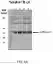 Fig. 08 - Downstream Processing of an Alkaline Phosphatase