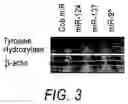 Fig. 04 - METHODS, SYSTEMS, AND COMPOSITIONS FOR NEURONAL DIFFERENTIATION OF MULTIPOTENT STROMAL CELLS