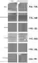 Fig. 16 - Inhibitors of CACNA1A/ALPHA1A subunit internal ribosomal entry site (IRES) and methods of treating spinocerebellar ataxia type 6