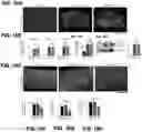 Fig. 17 - Inhibitors of CACNA1A/ALPHA1A subunit internal ribosomal entry site (IRES) and methods of treating spinocerebellar ataxia type 6