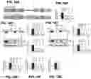 Fig. 19 - Inhibitors of CACNA1A/ALPHA1A subunit internal ribosomal entry site (IRES) and methods of treating spinocerebellar ataxia type 6