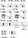 Fig. 21 - Inhibitors of CACNA1A/ALPHA1A subunit internal ribosomal entry site (IRES) and methods of treating spinocerebellar ataxia type 6