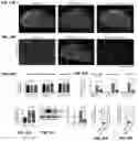 Fig. 22 - Inhibitors of CACNA1A/ALPHA1A subunit internal ribosomal entry site (IRES) and methods of treating spinocerebellar ataxia type 6