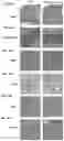 Fig. 36 - Inhibitors of CACNA1A/ALPHA1A subunit internal ribosomal entry site (IRES) and methods of treating spinocerebellar ataxia type 6
