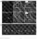 Fig. 03 - Marker, method and kit for observing effect of compound or drug on cells in real time, and use thereof
