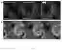 Fig. 04 - Marker, method and kit for observing effect of compound or drug on cells in real time, and use thereof