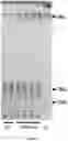 Fig. 08 - METHODS AND COMPOSITIONS FOR THE PRODUCTION OF LIPIDS