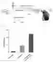 Fig. 02 - METHOD FOR DETECTING ATP BY USING PERSONAL BLOOD GLUCOSE METER
