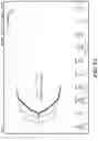 Fig. 14 - Detection and classification of an anticoagulant using a clotting assay