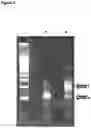 Fig. 05 - Method for nanopore RNA characterisation
