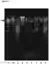 Fig. 15 - Method for nanopore RNA characterisation