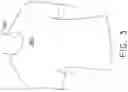 Fig. 04 - Moisture management support garment with a denier differential mechanism