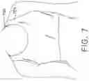Fig. 07 - Moisture management support garment with a denier differential mechanism