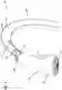 Fig. 05 - Faucet head alignment system