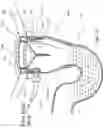 Fig. 60 - Hybrid trap with water injection