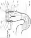 Fig. 62 - Hybrid trap with water injection