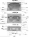 Fig. 05 - Monument cap device comprising a circular lid and an adhering structure