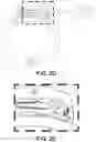 Fig. 05 - Restraint condition detection and notification system, devices, and methods