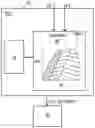 Fig. 01 - METHOD AND SYSTEM FOR CONTROLLING A VARIABLE-GEOMETRY COMPRESSOR