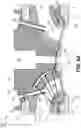 Fig. 10 - POLYMERIC AND METAL CYLINDER HEAD AND METHOD OF MAKING THE SAME