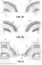 Fig. 14 - POLYMERIC AND METAL CYLINDER HEAD AND METHOD OF MAKING THE SAME