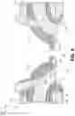 Fig. 15 - POLYMERIC AND METAL CYLINDER HEAD AND METHOD OF MAKING THE SAME