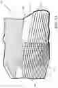 Fig. 05 - Airway pressure device with micro-pump system
