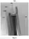 Fig. 04 - VANE LOCKING APPARATUS