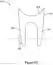 Fig. 18 - Chassis anchoring systems