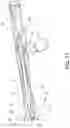 Fig. 11 - Bolt for bolt action rifles