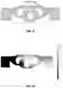 Fig. 06 - Mechanical strain amplifying transducer